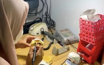 Kisah Fitriyyah, Alumni D3 Teknik Gigi UNAIR, Mulai Karier Sebelum Wisuda